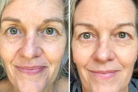 South Beach-#1 Wrinkle Cream That Works Like A Facelift