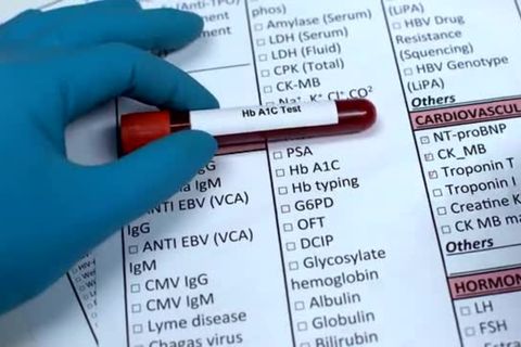 Did You Know-Why More Seniors Are Swapping Pills for This Natural Blood Sugar Support