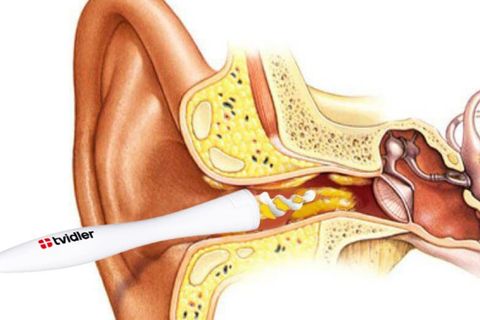 Tvidler-Stop Using Q-Tips To Clean Your Ears